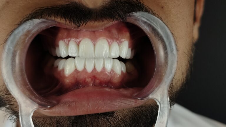 filter: 0; fileterIntensity: 0.0; filterMask: 0; algolist: 0;
multi-frame: 1;
brp_mask:0;
brp_del_th:null;
brp_del_sen:null;
delta:null;
module: photo;hw-remosaic: false;touch: (0.520029, 0.4263916);sceneMode: 32768;cct_value: 0;AI_Scene: (-1, -1);aec_lux: 0.0;aec_lux_index: 0;albedo:  ;confidence:  ;motionLevel: -1;weatherinfo: null;temperature: 42;