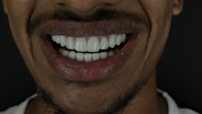 filter: 0; fileterIntensity: 0.0; filterMask: 0; algolist: 0;
multi-frame: 1;
brp_mask:0;
brp_del_th:null;
brp_del_sen:null;
delta:null;
module: photo;hw-remosaic: false;touch: (0.5862196, 0.43010443);sceneMode: 32768;cct_value: 0;AI_Scene: (-1, -1);aec_lux: 0.0;aec_lux_index: 0;albedo:  ;confidence:  ;motionLevel: -1;weatherinfo: null;temperature: 37;