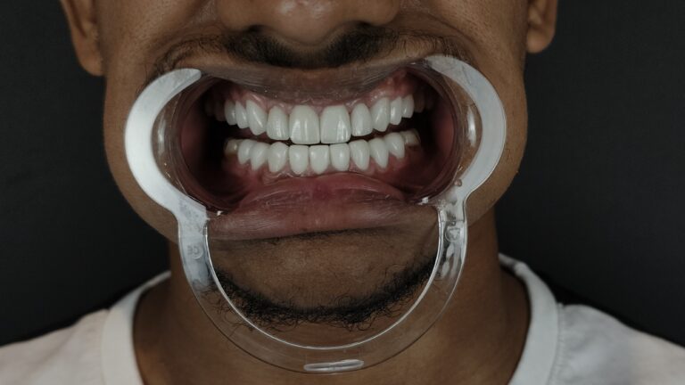 filter: 0; fileterIntensity: 0.0; filterMask: 0; algolist: 0;
multi-frame: 1;
brp_mask:0;
brp_del_th:null;
brp_del_sen:null;
delta:null;
module: photo;hw-remosaic: false;touch: (-1.0, -1.0);sceneMode: 32768;cct_value: 0;AI_Scene: (-1, -1);aec_lux: 0.0;aec_lux_index: 0;albedo:  ;confidence:  ;motionLevel: -1;weatherinfo: null;temperature: 40;