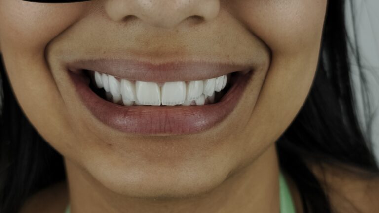 filter: 0; fileterIntensity: 0.0; filterMask: 0; algolist: 0;
multi-frame: 1;
brp_mask:0;
brp_del_th:null;
brp_del_sen:null;
delta:null;
module: photo;hw-remosaic: false;touch: (0.5898363, 0.52262384);sceneMode: 32768;cct_value: 0;AI_Scene: (-1, -1);aec_lux: 0.0;aec_lux_index: 0;albedo:  ;confidence:  ;motionLevel: -1;weatherinfo: null;temperature: 26;