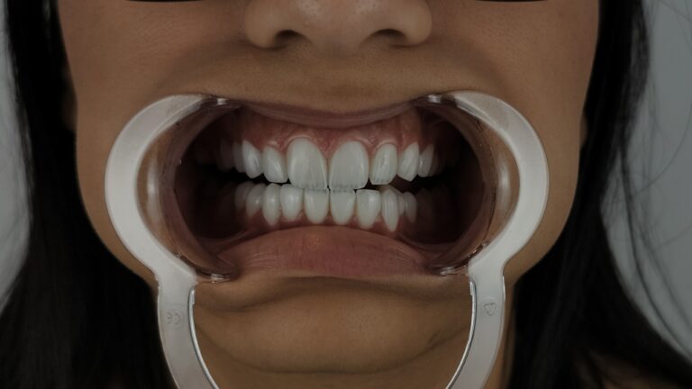 filter: 0; fileterIntensity: 0.0; filterMask: 0; algolist: 0;
multi-frame: 1;
brp_mask:0;
brp_del_th:null;
brp_del_sen:null;
delta:null;
module: photo;hw-remosaic: false;touch: (0.5516771, 0.49536133);sceneMode: 32768;cct_value: 0;AI_Scene: (-1, -1);aec_lux: 0.0;aec_lux_index: 0;albedo:  ;confidence:  ;motionLevel: -1;weatherinfo: null;temperature: 35;