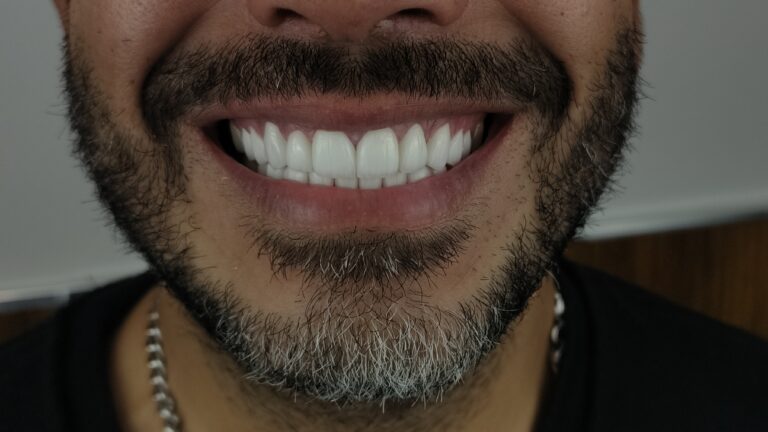 filter: 0; fileterIntensity: 0.0; filterMask: 0; algolist: 0;
multi-frame: 1;
brp_mask:0;
brp_del_th:null;
brp_del_sen:null;
delta:null;
module: photo;hw-remosaic: false;touch: (-1.0, -1.0);sceneMode: 32768;cct_value: 0;AI_Scene: (-1, -1);aec_lux: 0.0;aec_lux_index: 0;albedo:  ;confidence:  ;motionLevel: -1;weatherinfo: null;temperature: 33;