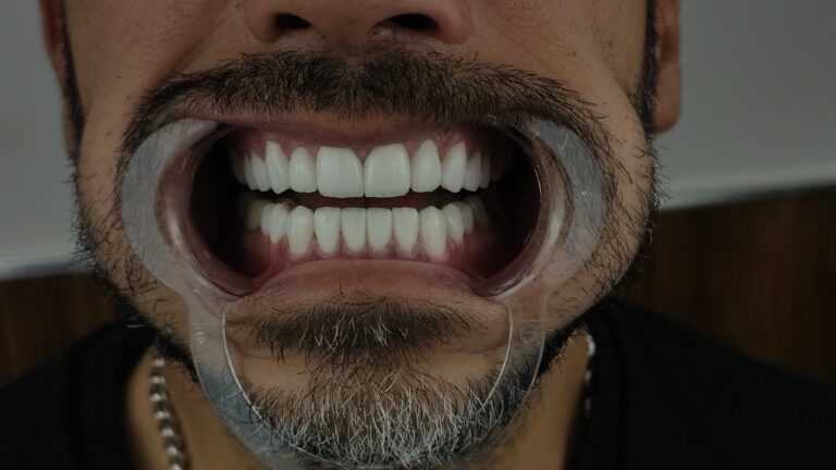 filter: 0; fileterIntensity: 0.0; filterMask: 0; algolist: 0;
multi-frame: 1;
brp_mask:0;
brp_del_th:null;
brp_del_sen:null;
delta:null;
module: photo;hw-remosaic: false;touch: (0.59182537, 0.46031684);sceneMode: 32768;cct_value: 0;AI_Scene: (-1, -1);aec_lux: 0.0;aec_lux_index: 0;albedo:  ;confidence:  ;motionLevel: -1;weatherinfo: null;temperature: 38;