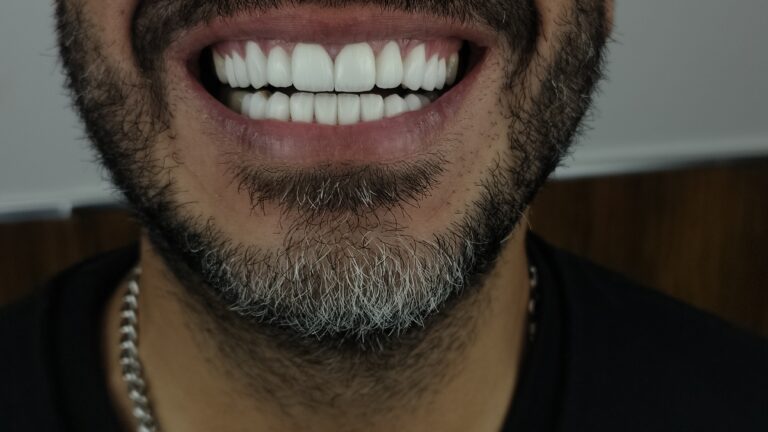 filter: 0; fileterIntensity: 0.0; filterMask: 0; algolist: 0;
multi-frame: 1;
brp_mask:0;
brp_del_th:null;
brp_del_sen:null;
delta:null;
module: photo;hw-remosaic: false;touch: (0.72312146, 0.51850396);sceneMode: 32768;cct_value: 0;AI_Scene: (-1, -1);aec_lux: 0.0;aec_lux_index: 0;albedo:  ;confidence:  ;motionLevel: -1;weatherinfo: null;temperature: 39;