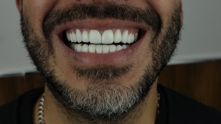 filter: 0; fileterIntensity: 0.0; filterMask: 0; algolist: 0;
multi-frame: 1;
brp_mask:0;
brp_del_th:null;
brp_del_sen:null;
delta:null;
module: photo;hw-remosaic: false;touch: (0.72312146, 0.51850396);sceneMode: 32768;cct_value: 0;AI_Scene: (-1, -1);aec_lux: 0.0;aec_lux_index: 0;albedo:  ;confidence:  ;motionLevel: -1;weatherinfo: null;temperature: 39;